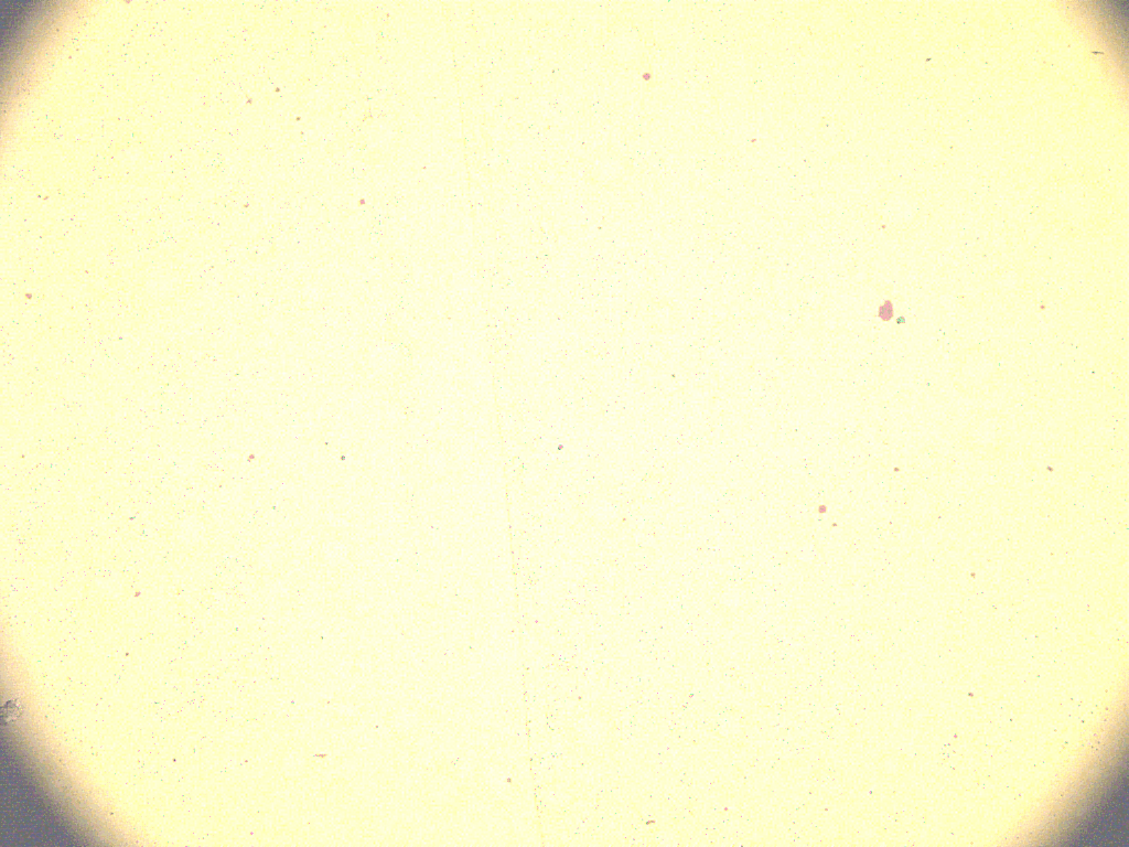 horizontal increase in size